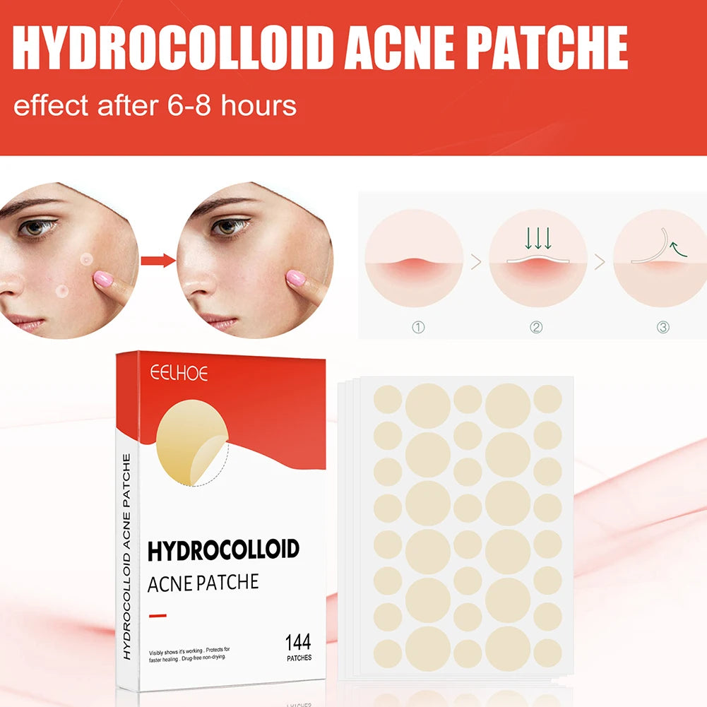 144Pcs Pimple Patch Invisible Face Spot Scar Care Treat-Ment Stickers Face Skin Care Moisturizing Beauty Health Acne Mask Beauty